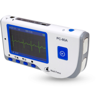 EKG monitor